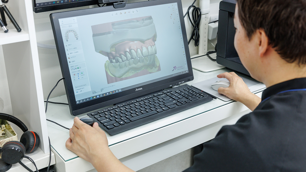 CAD・デジタルデンチャー設計